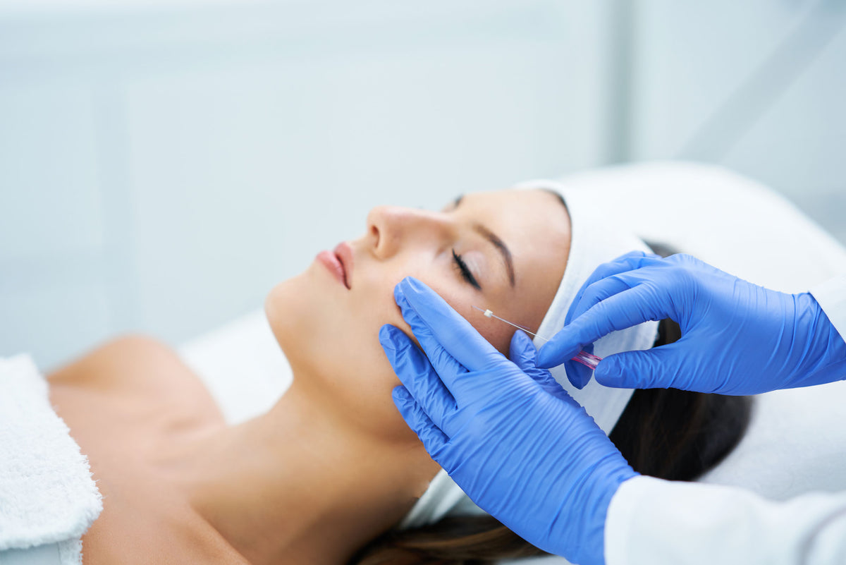 Facelift without surgery: Discover the magic of thread lifting